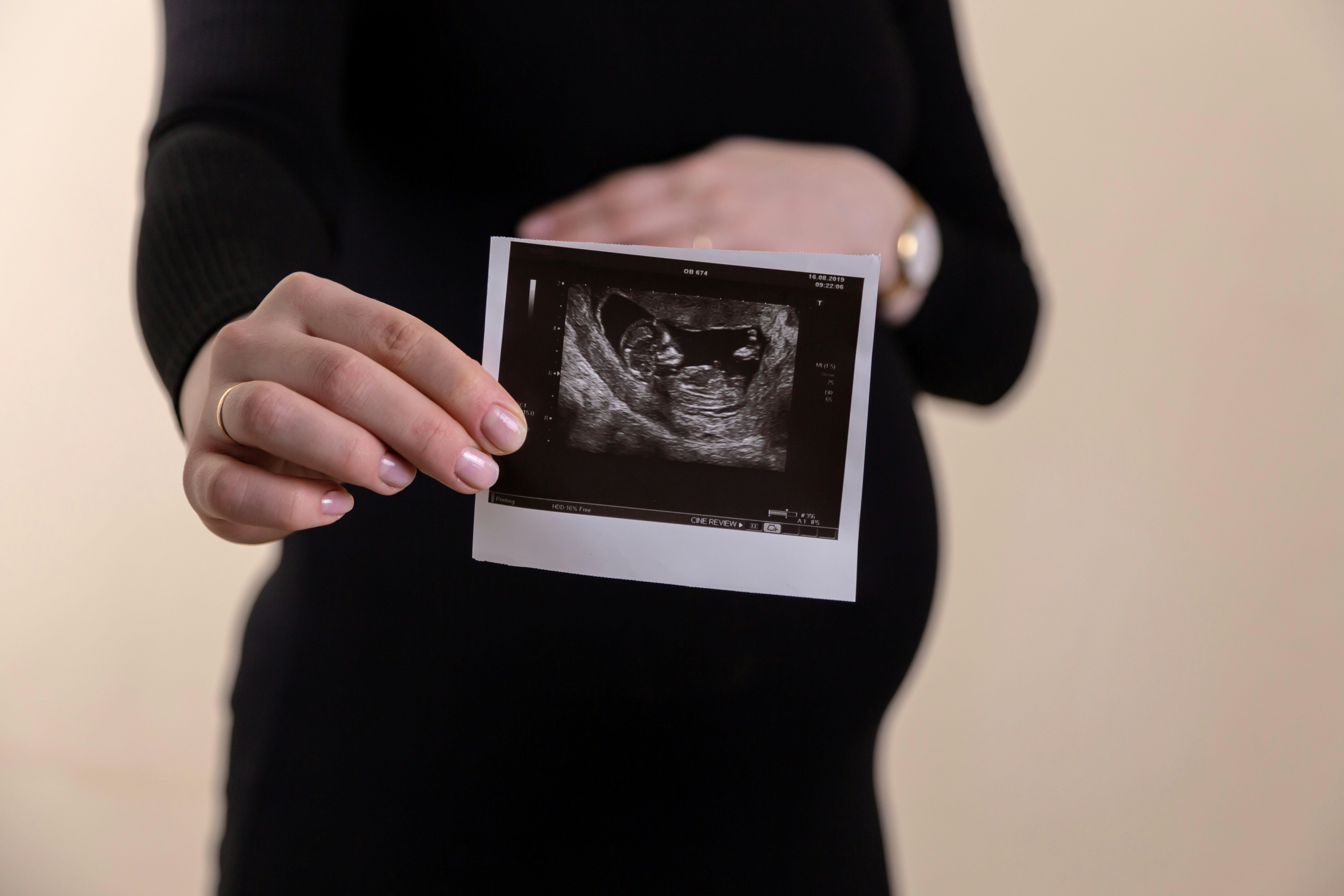 How Naturopathic Care Can Support You Through IVF
