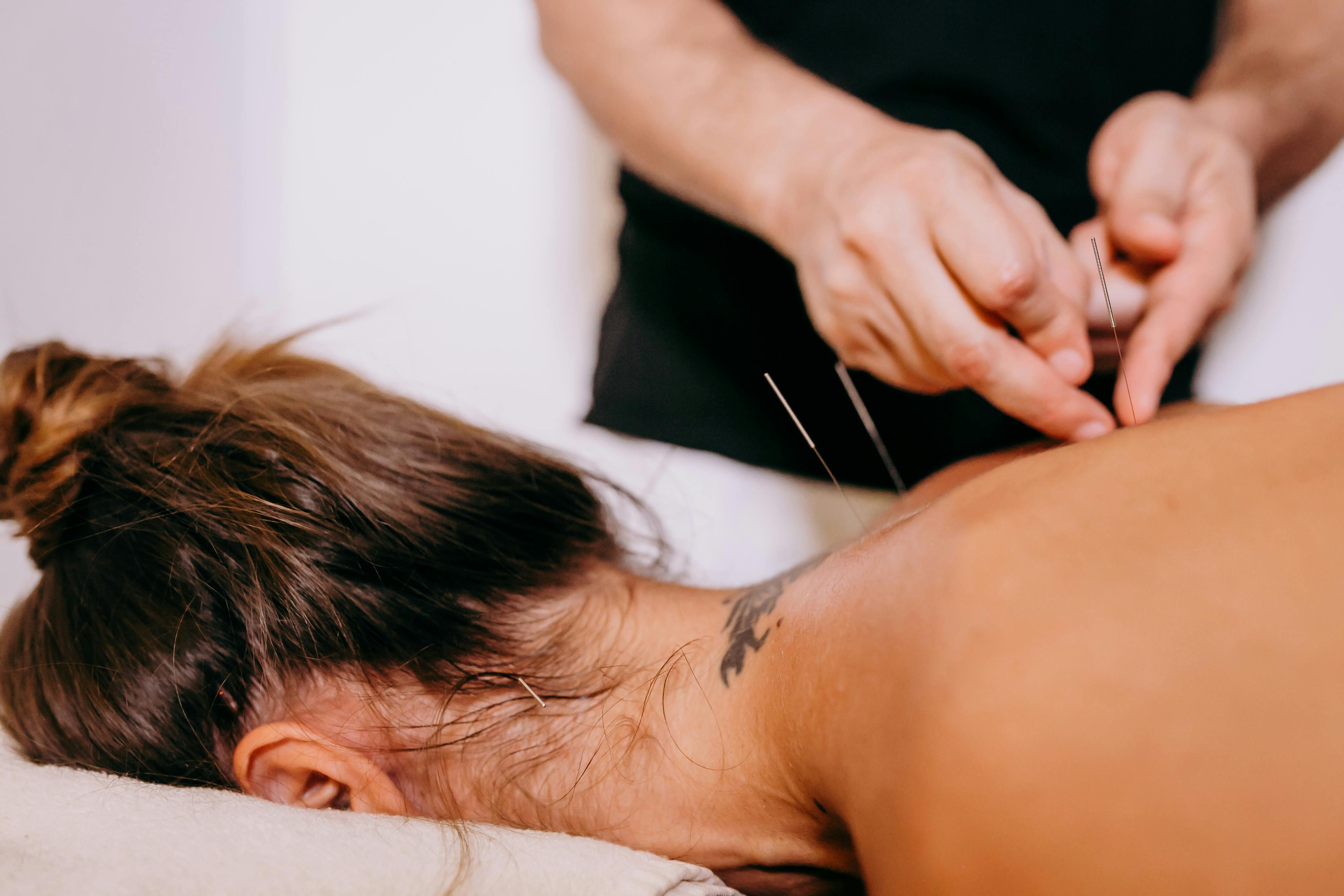 How Acupuncture Can Support You in Pregnancy